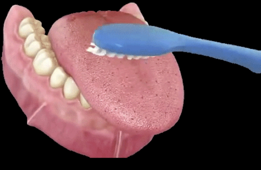 تنظيف الأسنان واللسان ضروري جدا لحمايتها من الأمراض وبقايا الطعام