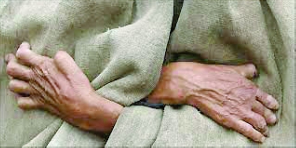 من أشكال مرض الجذام