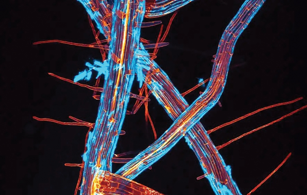 التفاصيل الدقيقة لجذور نبات الأرابيدوبسيس ثاليانا «رشاد الصخر»