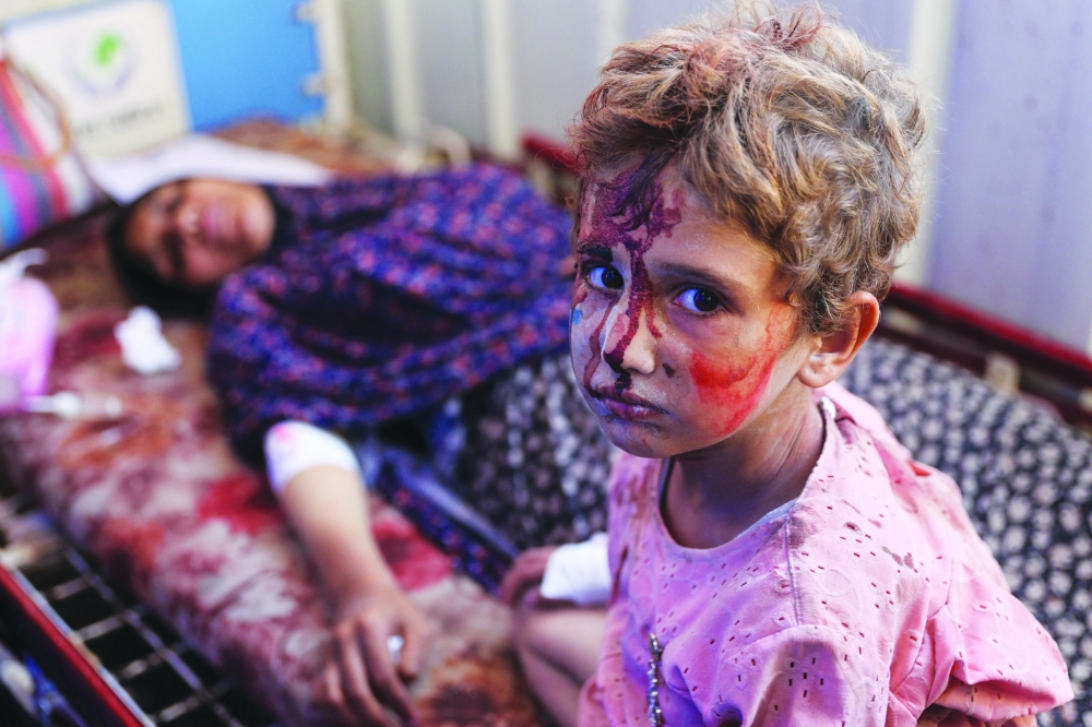 ملامح طفلة فلسطينية تنظر نحو المصور تظهر مدى بشاعة الألم والجراح التي يتلقاها يوميًا أطفال غزة في ظل حرب لا ترحم منذ نحو قرابة عام